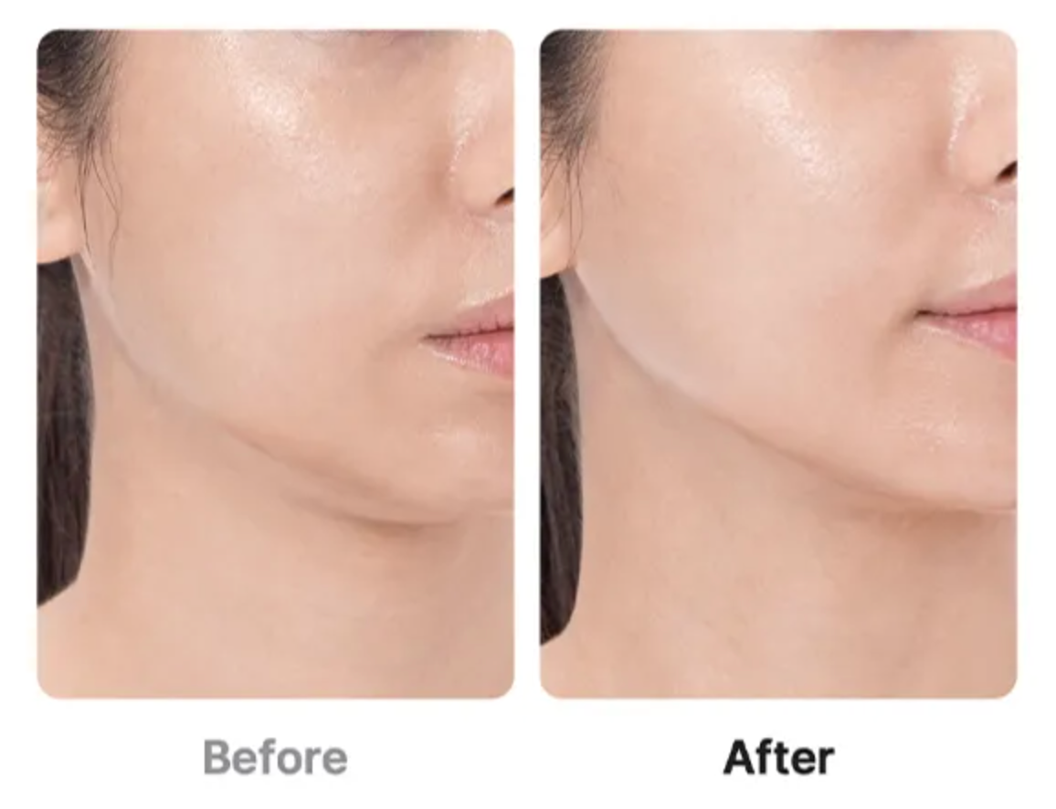 Age-R Booster Pro Glow-Set