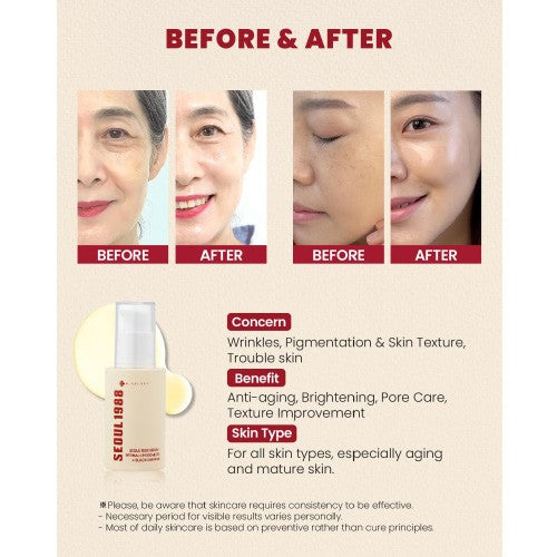 [KSECRET] SEOUL 1988 Cream : Retinal Liposome 1% + Fermented Rice [50ml]