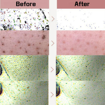 Red Bean Retinol Pore Peel To Foam [120ml]