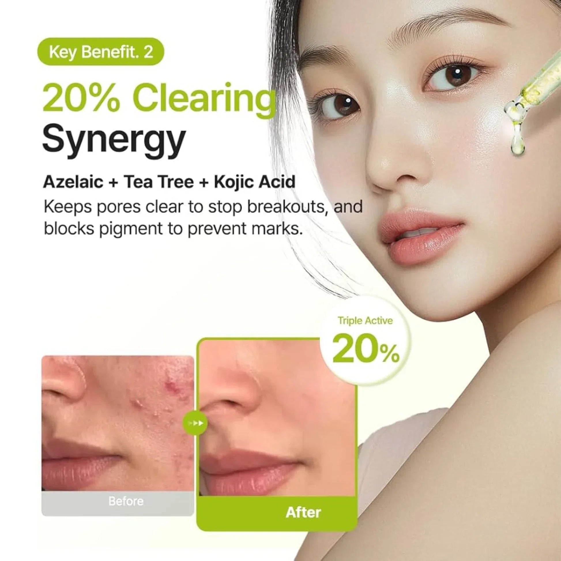 Azelaic Acid 10 Kojic Tea Tree Serum [30ml] (EU)
