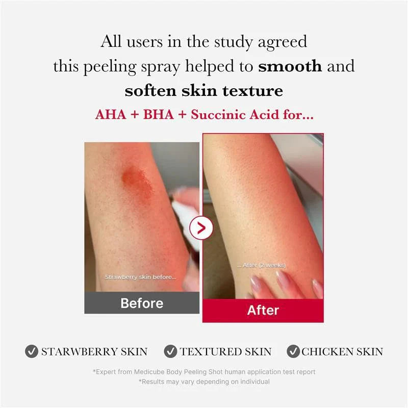 Red Acne Body Peeling Shot [110g]