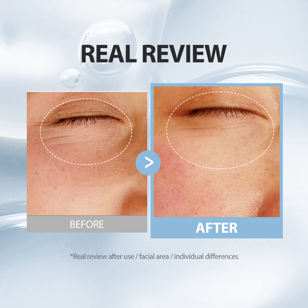 Deep Collagen Anti-wrinkle Power Boosting Cream In Serum (EU)