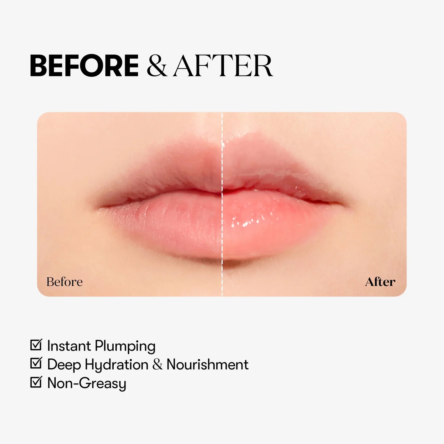 Reedle Shot Lip Plumper Expert [4.3g]