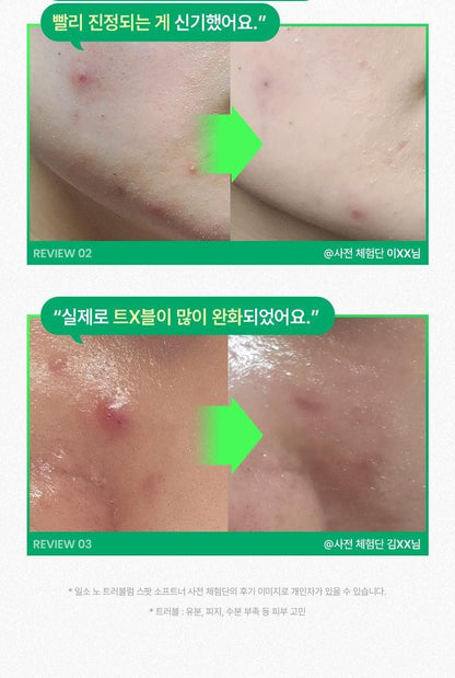 No Problem Spot Softener [150g]