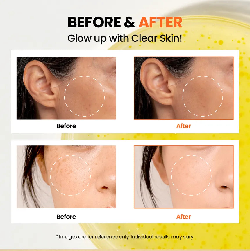 SEOUL 1988 Glow Serum: Niacinamide 15% + Yuja [30ml]