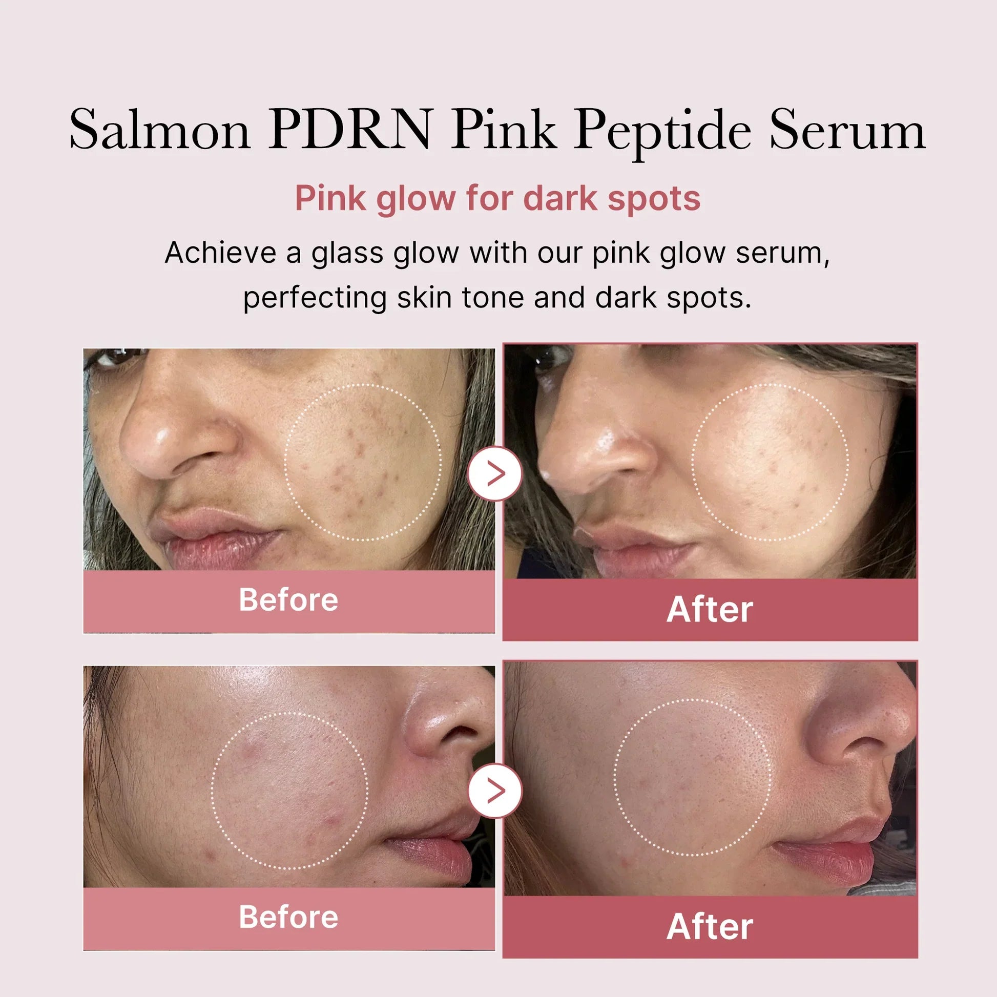 PDRN Pink Peptide Serum [30ml]