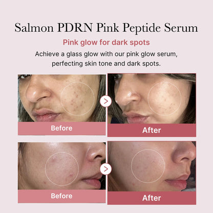 PDRN Pink Peptide Serum [30ml]