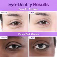 No.9 NAD Under Eye Patches [5pc]