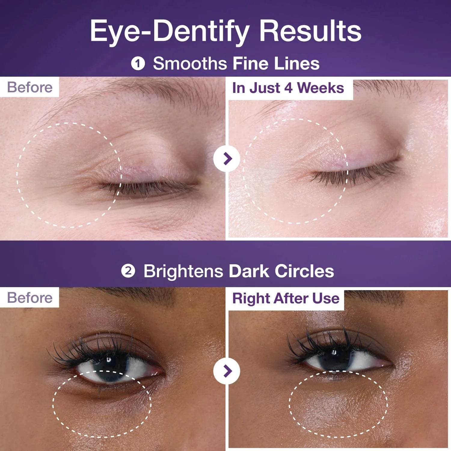 No.9 NAD+ Retinol Volumetox Eye Cream [10ml]