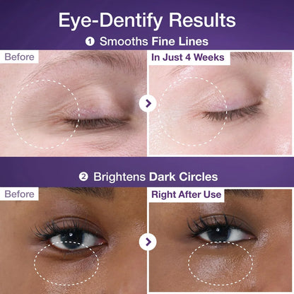 No.9 NAD+ Retinol Volumetox Eye Cream [10ml]