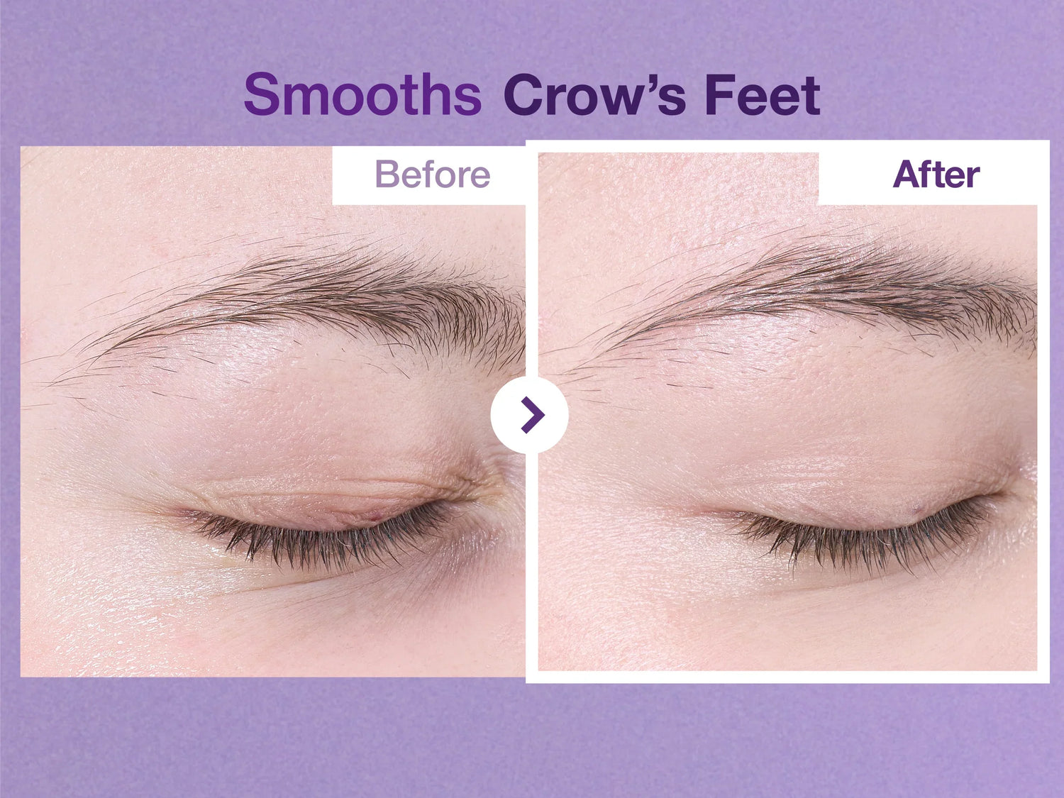 No.9 NAD+ Retinol Volumetox Eye Cream [10ml]