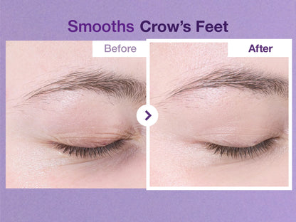 No.9 NAD+ Retinol Volumetox Eye Cream [10ml]